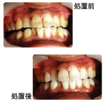 �N���[�j���O�����O������